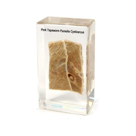Cisticerco (parásito tenia del cerdo)