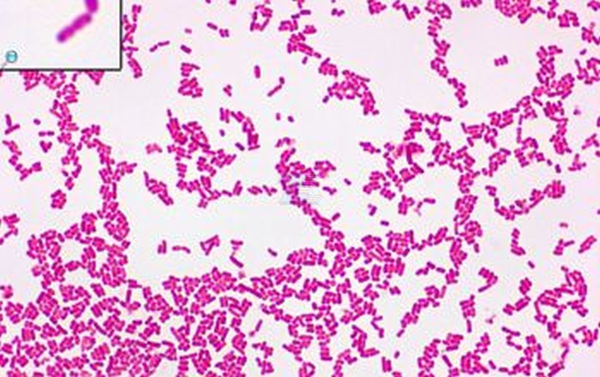 SET 12 preparados bacterias - Imagen 2