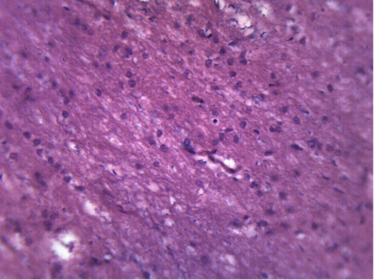 SET 25 preparados histología humana - Imagen 2